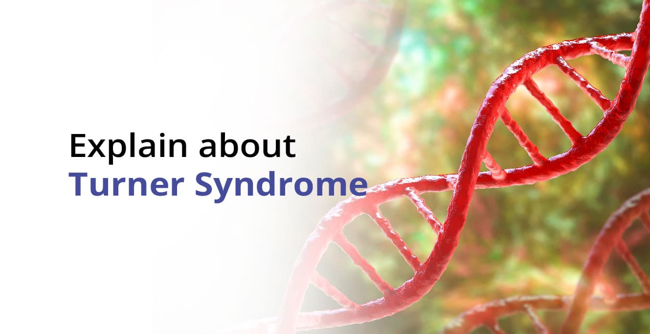 टर्नर सिंड्रोम क्या है? लक्षण, कारण और उपचार &#8211; Turner Syndrome in Hindi