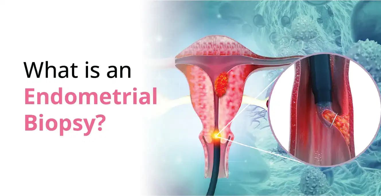 Endometrial Biopsy: Purpose, Procedure, and Risks