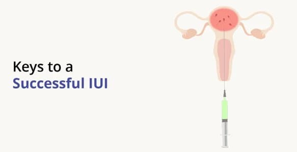 IUI Success Rate: Age-Wise Chances, Success Factors & Expert Tips