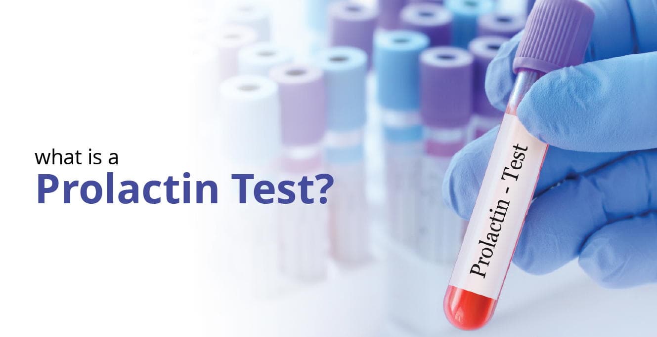 Prolactin Test: What is It and Why is It Done?