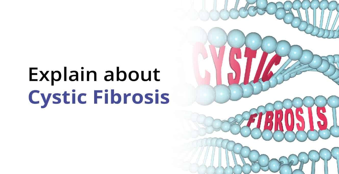 Cystic Fibrosis: Causes, Symptoms, Diagnosis, Treatment & Life Expectancy
