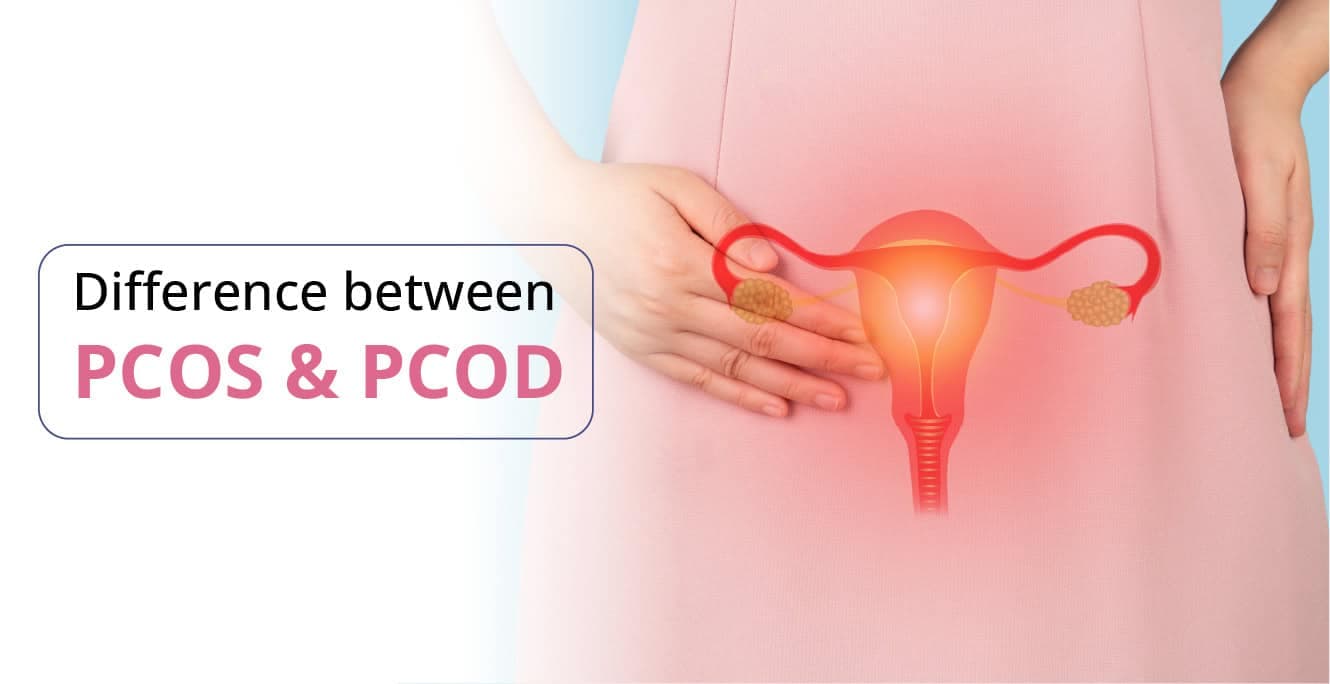 PCOS અને PCOD વચ્ચે શું તફાવત છે