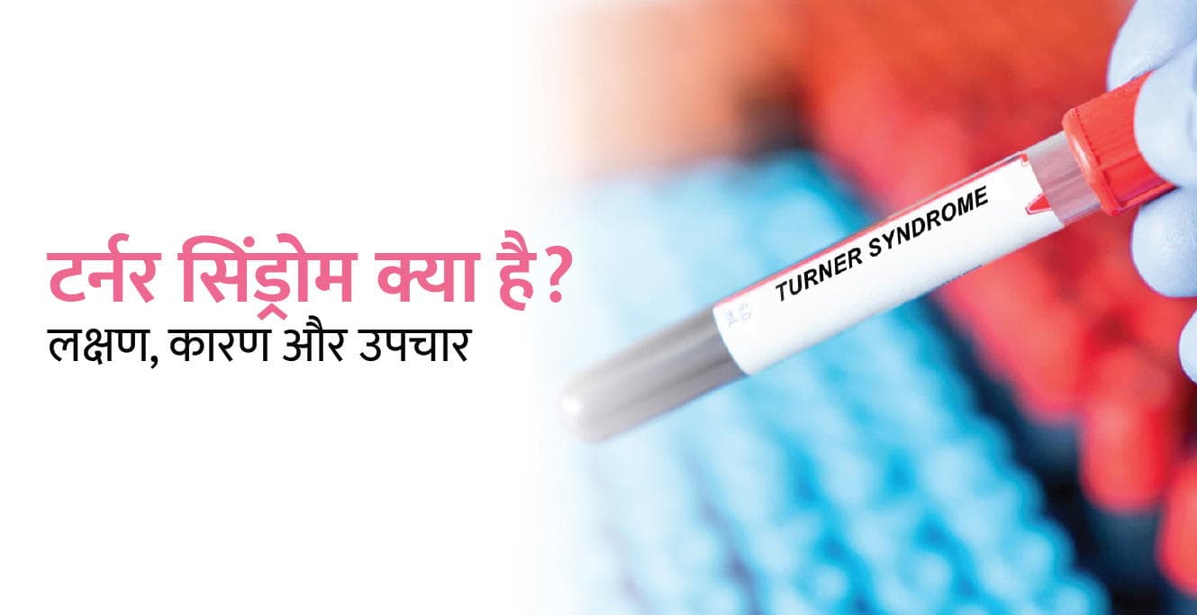 टर्नर सिंड्रोम क्या है? लक्षण, कारण और उपचार – Turner Syndrome in Hindi