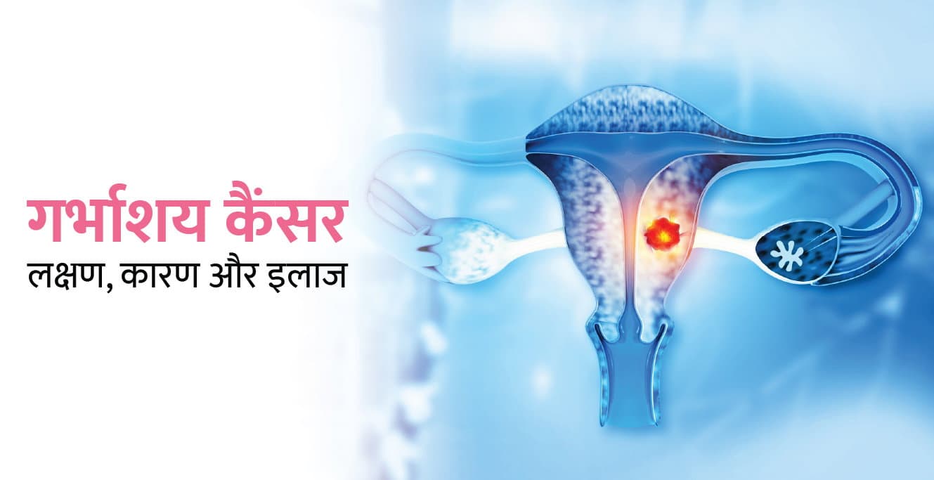 Uterine Cancer in Hindi – गर्भाशय कैंसर के लक्षण, कारण और इलाज