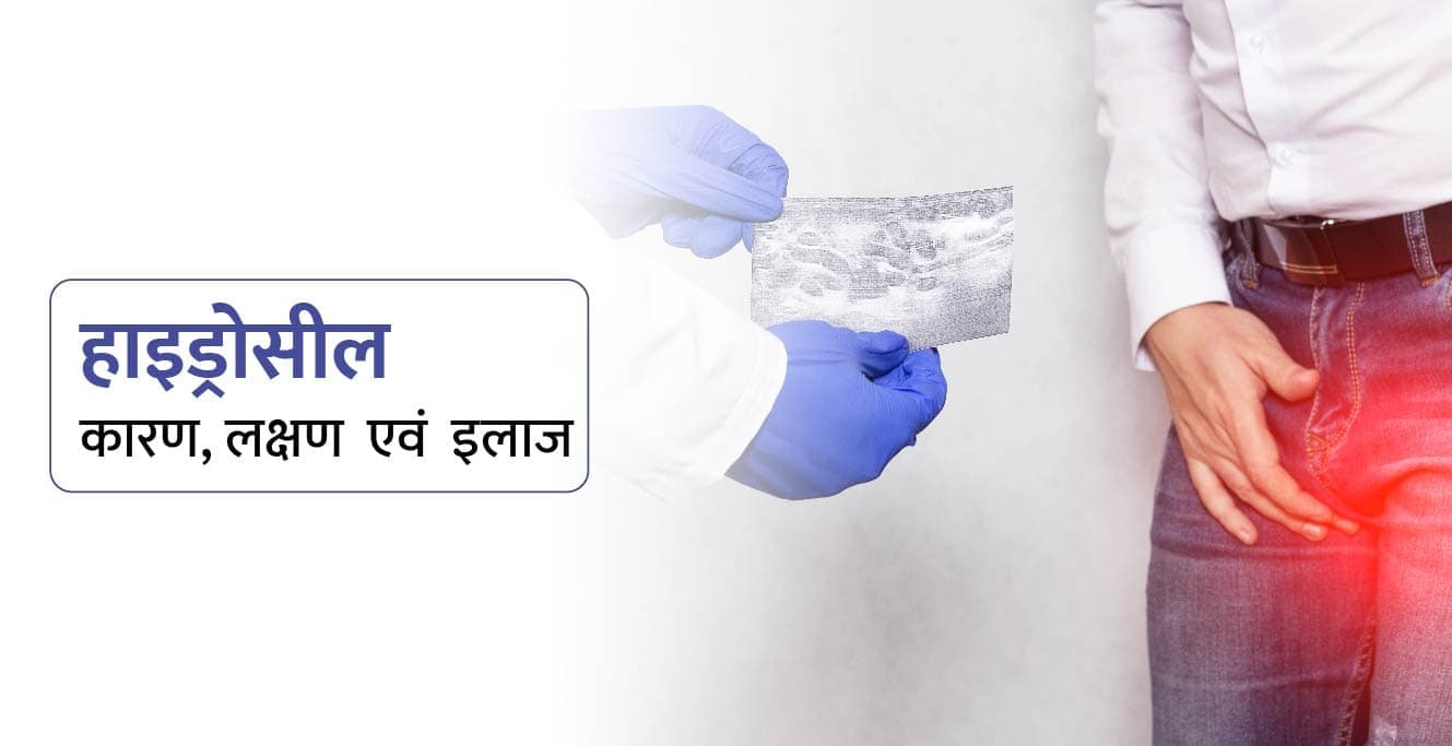 हाइड्रोसील: कारण, लक्षण और इलाज की पूरी जानकारी