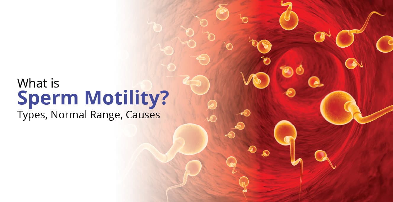 The Role of Sperm Motility in Male Fertility