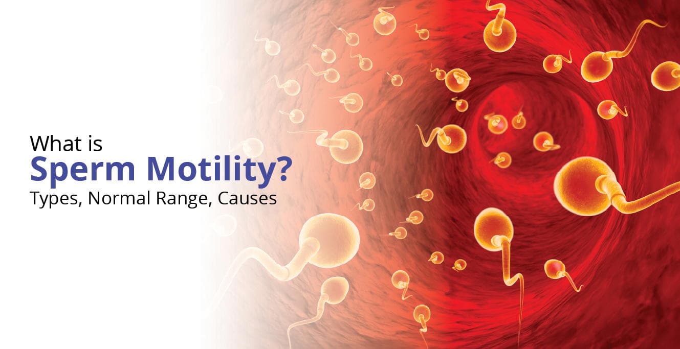 The Role of Sperm Motility in Male Fertility
