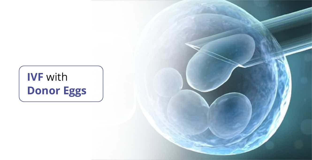 ദാതാവിന്റെ മുട്ടകൾക്കൊപ്പം IVF: നിങ്ങളുടെ സാധ്യതകൾ എന്തൊക്കെയാണ്?