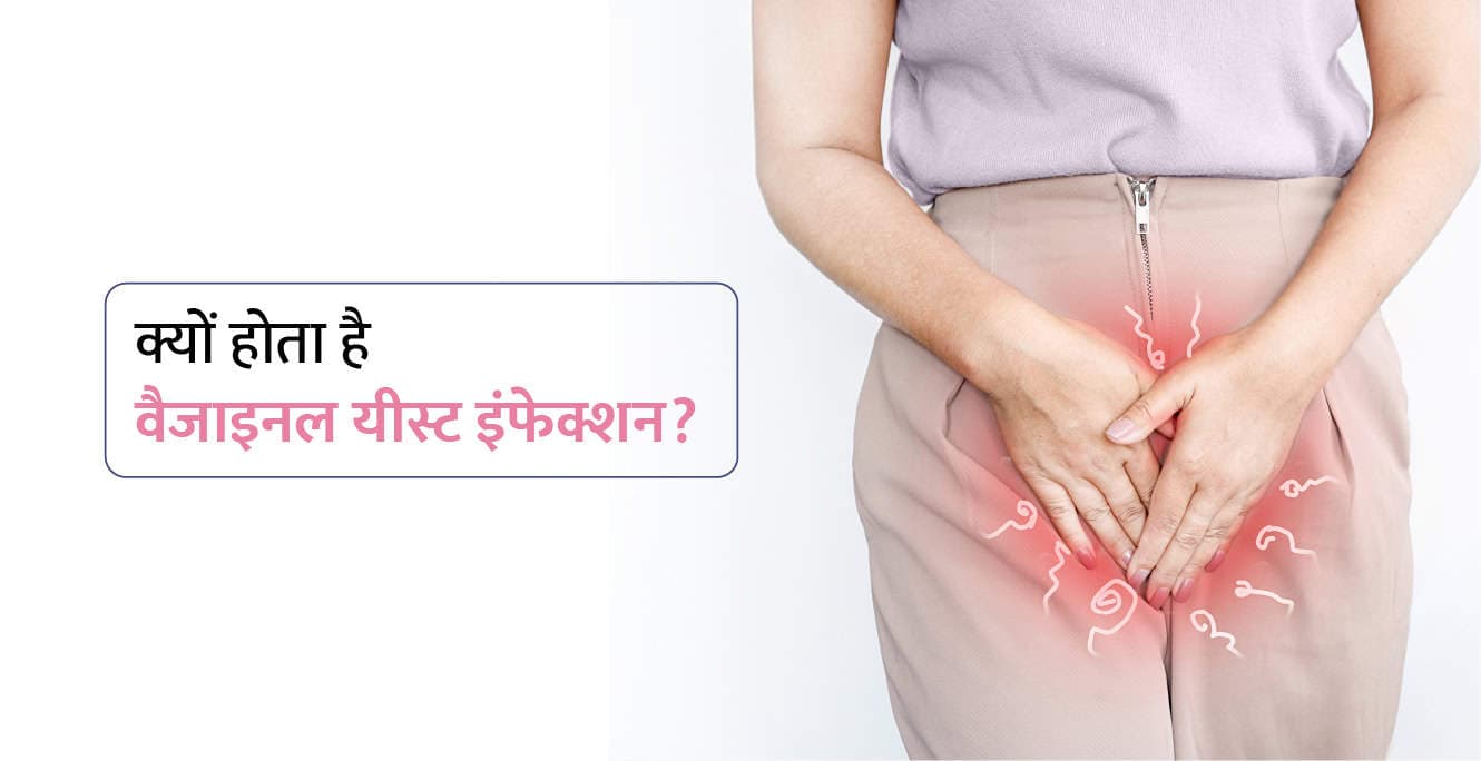 योनि में यीस्ट संक्रमण के कारण, लक्षण और उपचार