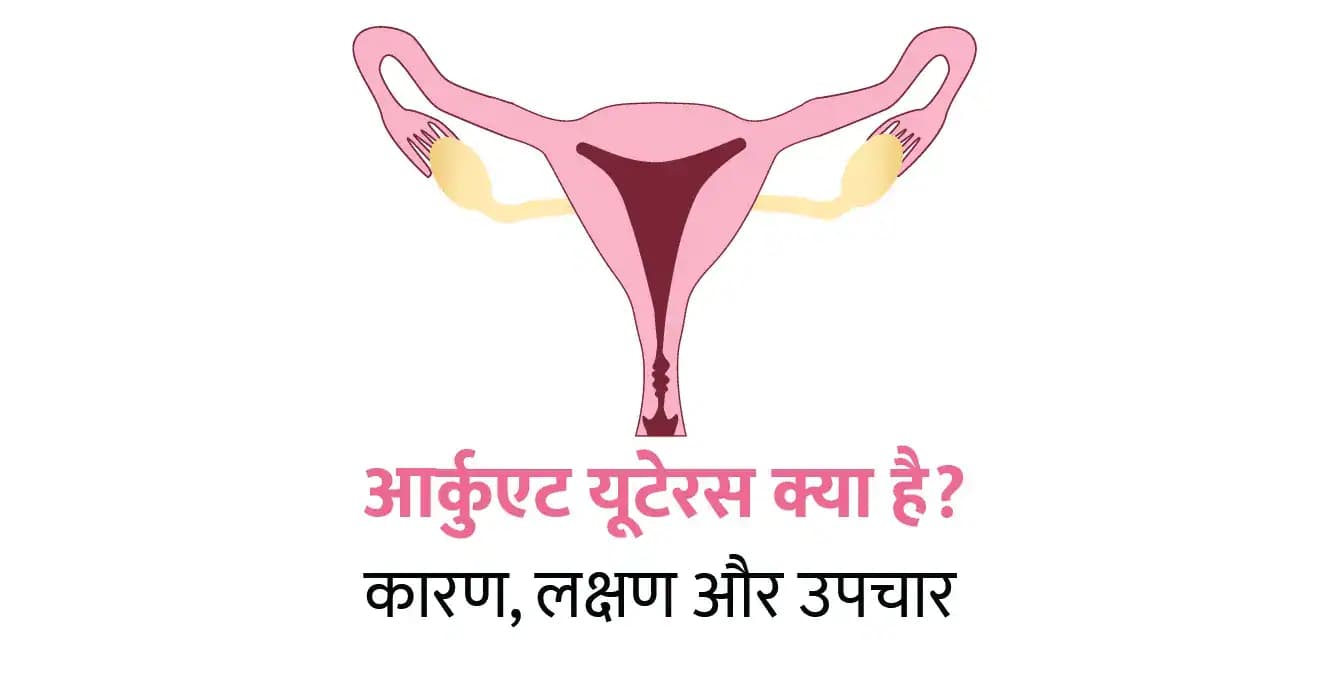 आर्कुएट यूटेरस क्या है? कारण, लक्षण और उपचार