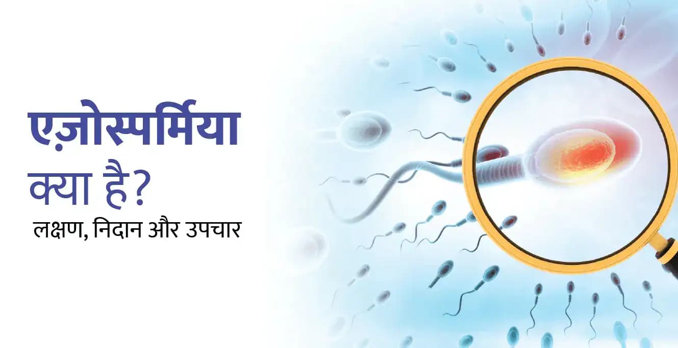 एज़ोस्पर्मिया क्या है? कारण, लक्षण, निदान और उपचार (Azoospermia in Hindi)