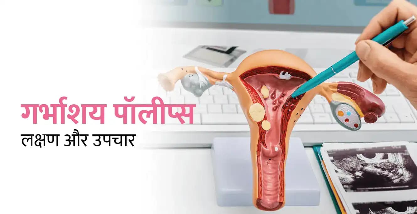 एंडोमेट्रियल पॉलीप्स (गर्भाशय पॉलीप्स): लक्षण, कारण और उपचार