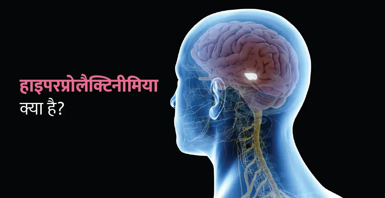 हाइपरप्रोलैक्टिनीमिया क्या है? कारण, लक्षण, जांच और उपचार