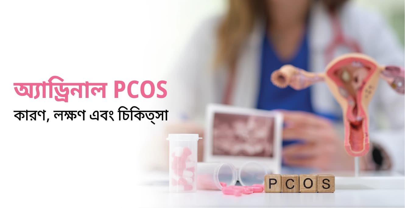 অ্যাড্রিনাল PCOS: কারণ, লক্ষণ এবং চিকিত্সা
