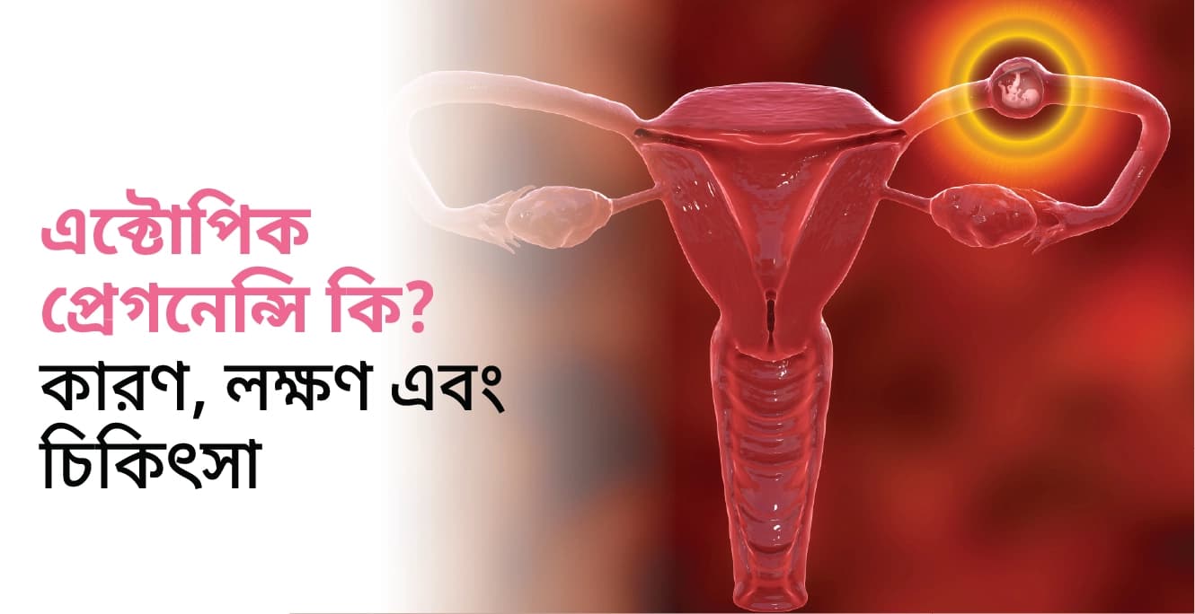 এক্টোপিক প্রেগনেন্সি কি? কারণ, লক্ষণ চিকিৎসা এবং