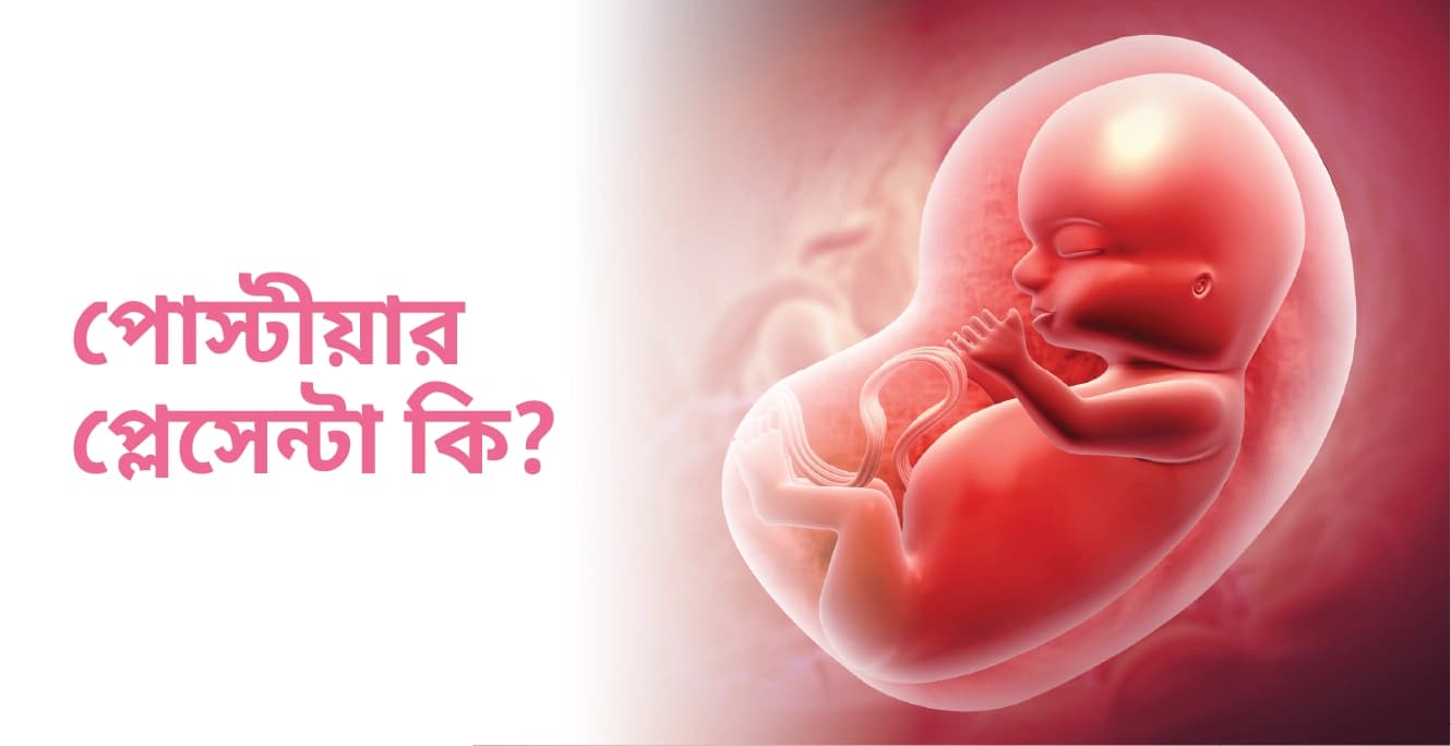 পোস্টীয়ার প্লেসেন্টা কি? গর্ভাবস্থায় প্লেসেন্টের ভূমিকা