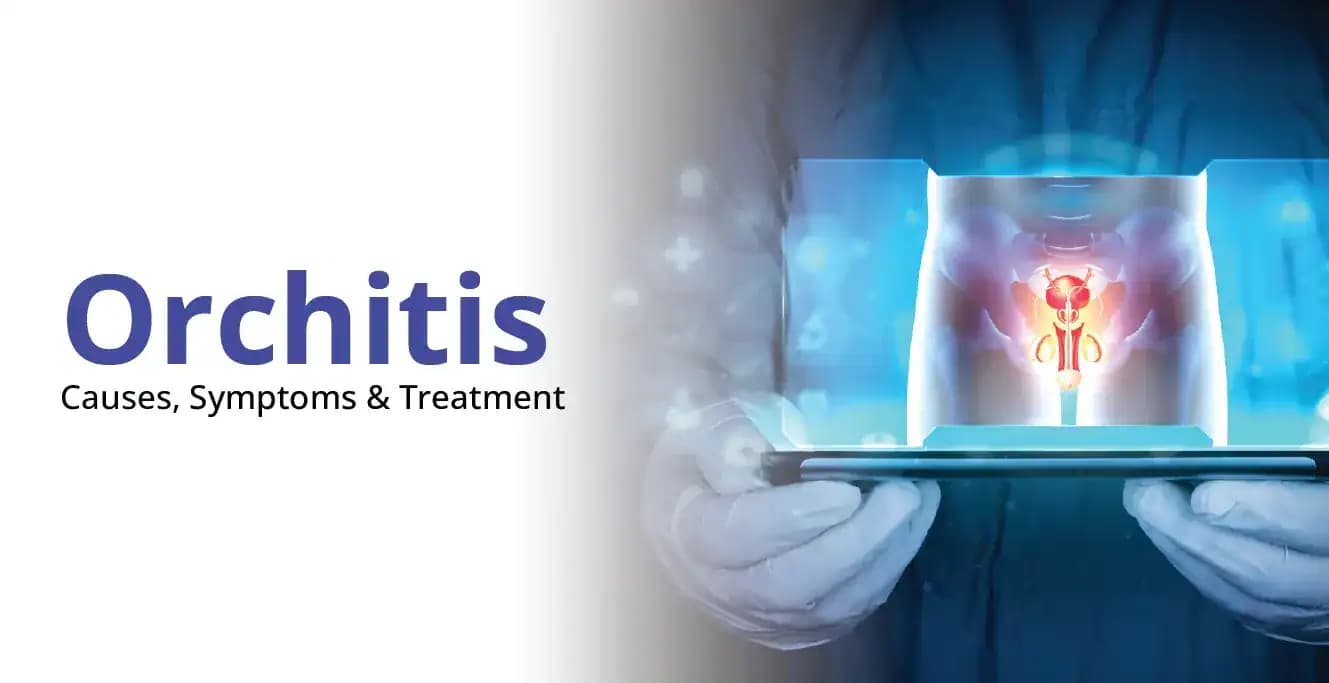 Orchitis: Causes, Symptoms & Treatment