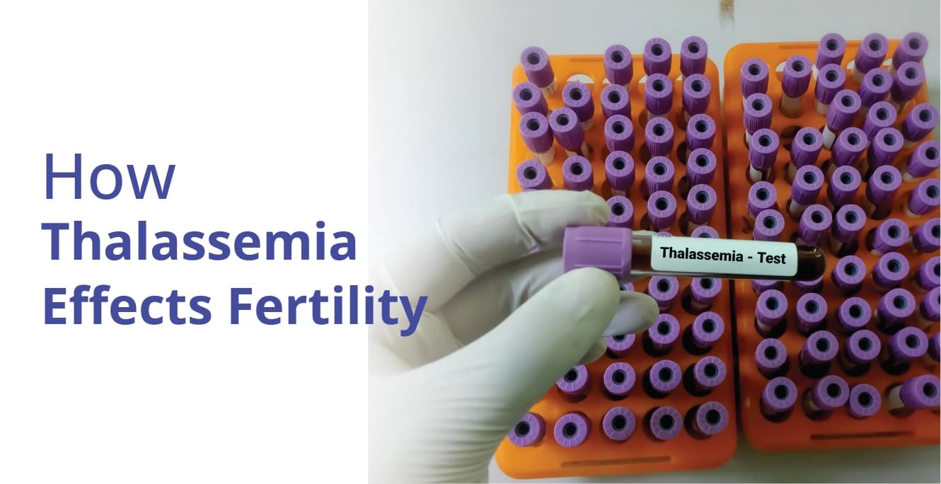 How Thalassemia Effects Fertility
