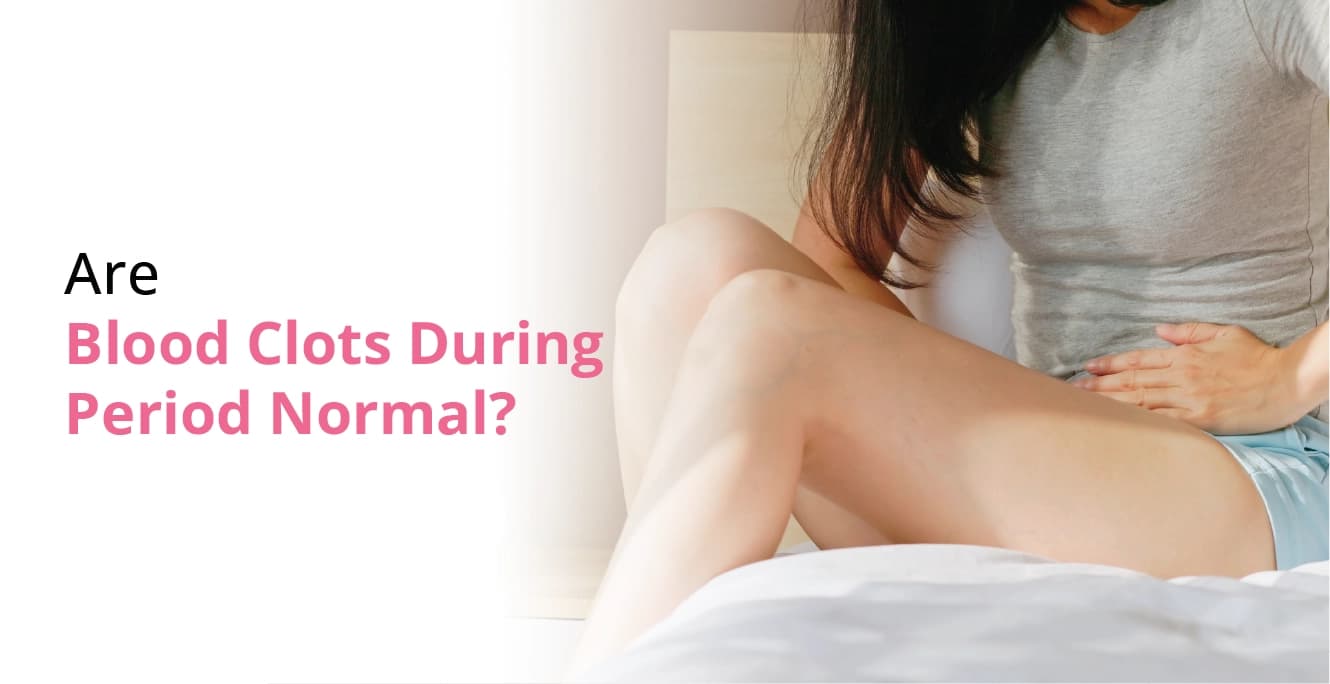 Are Blood Clots During a Period Normal?