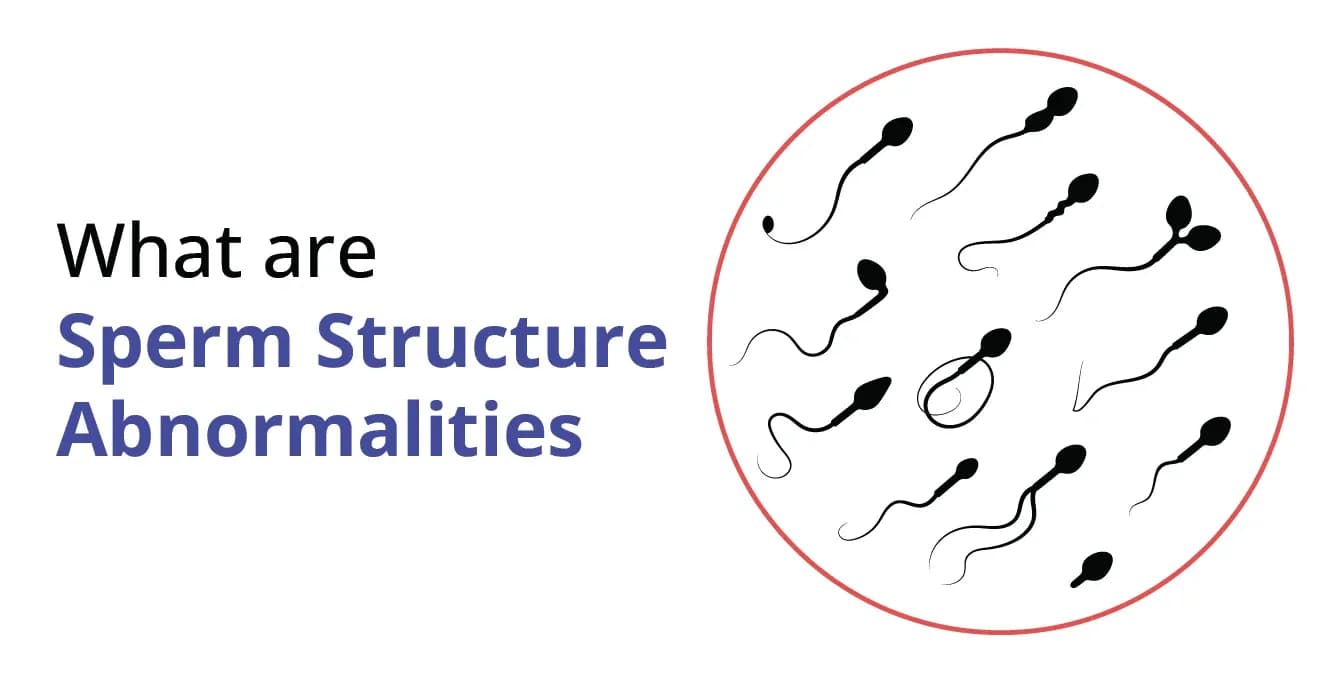 Sperm Abnormalities: Types, Causes & Treatment
