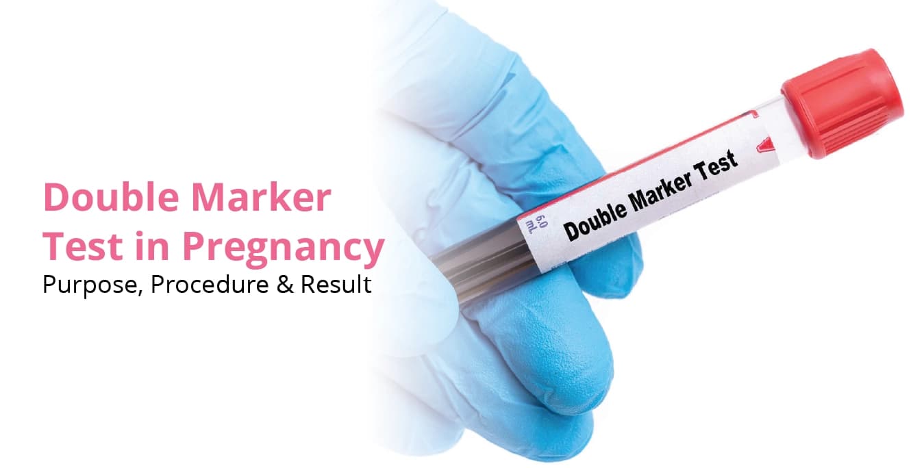 Double Marker Test: Procedure, Benefits and Results