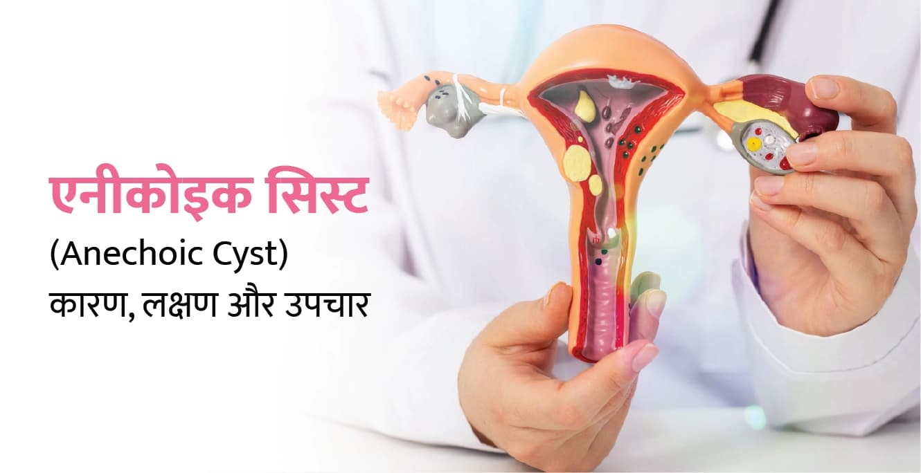 एनेकोइक सिस्ट: कारण, लक्षण और इलाज