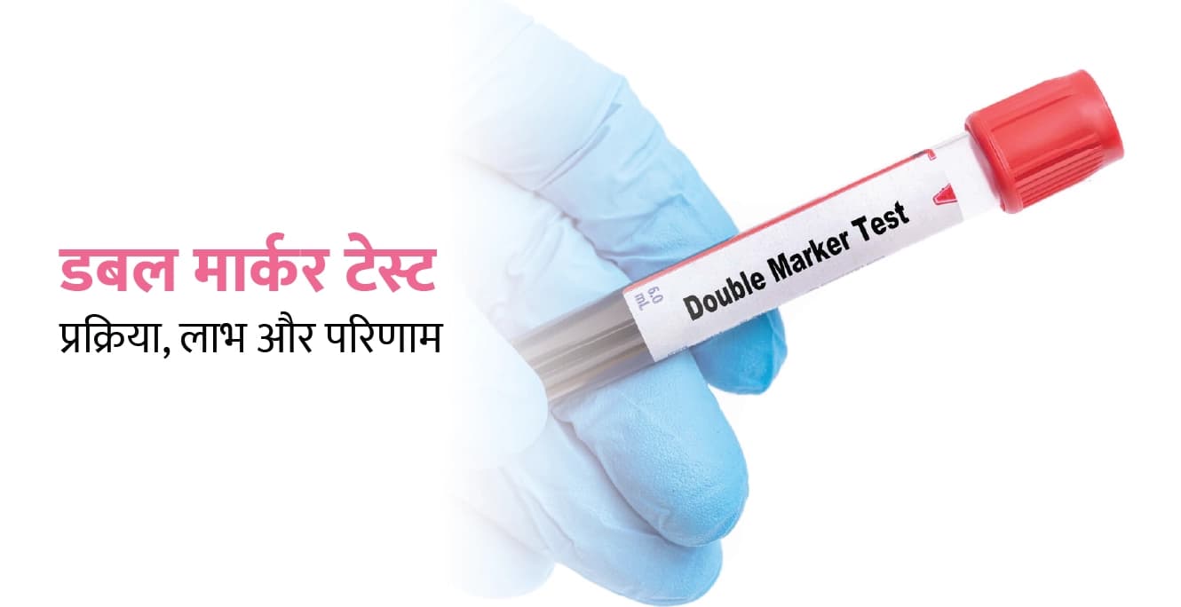 डबल मार्कर टेस्ट क्या है?