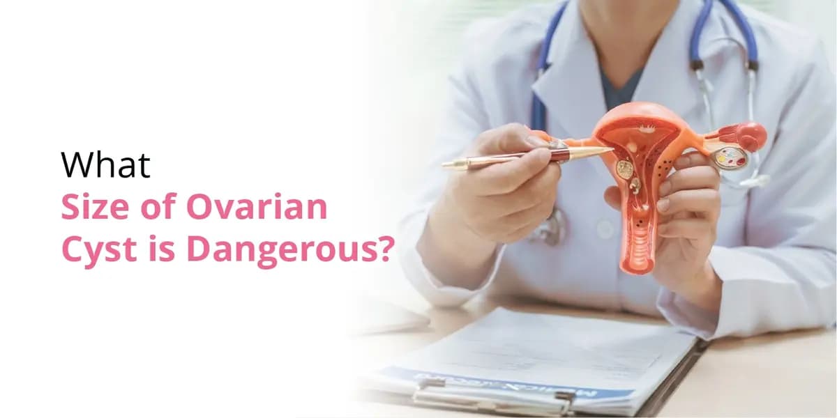 What Size of Ovarian Cyst Is Dangerous? Size Chart, Symptoms & Treatment