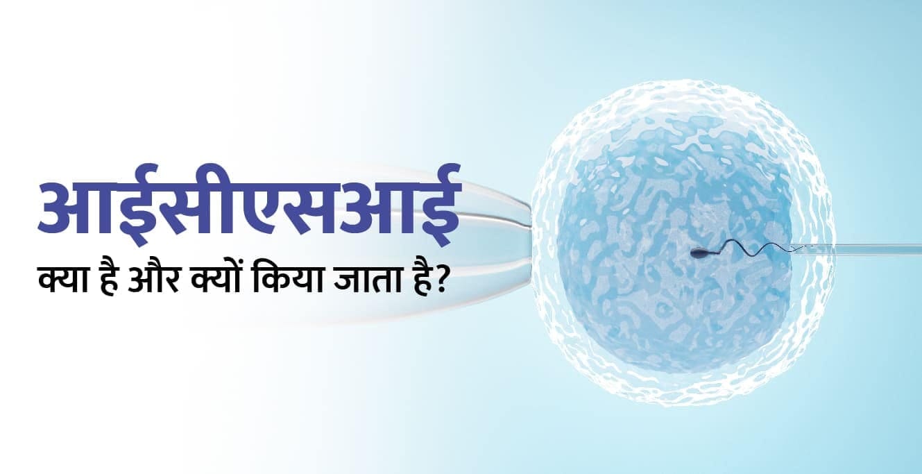 आईसीएसआई (ICSI) क्या है और उपचार की तैयारी