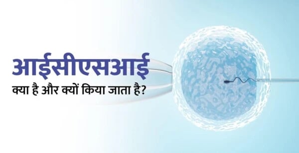 आईसीएसआई (ICSI) क्या है और उपचार की तैयारी