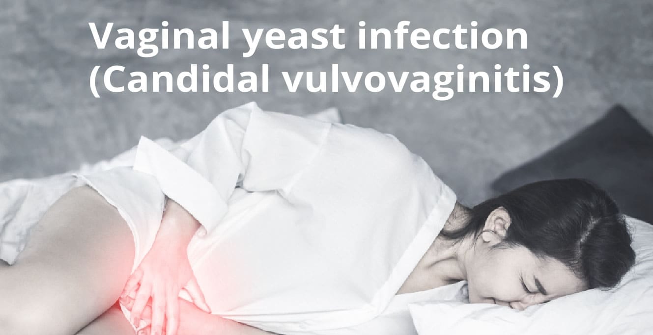 Vaginal Yeast Infection