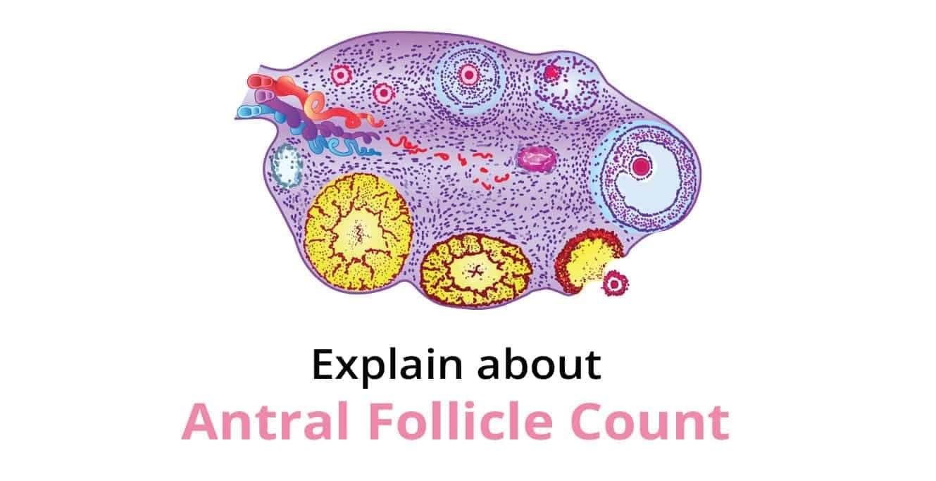 Antral Follicle Count (AFC) কি?