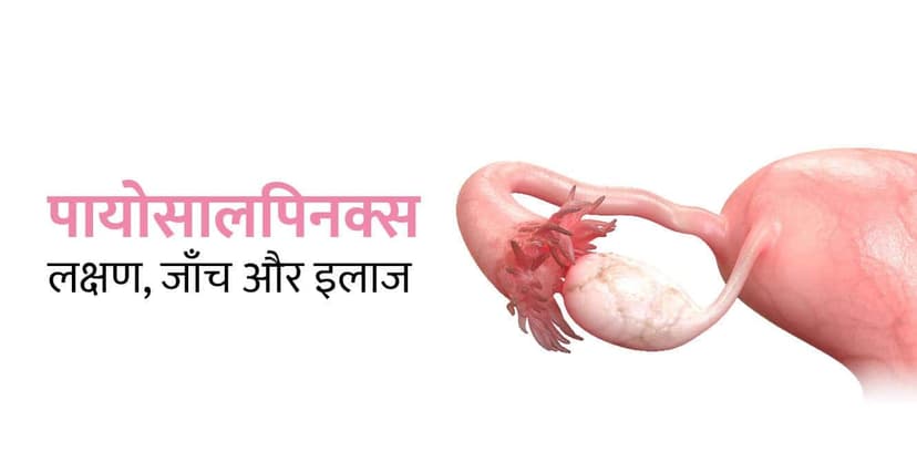 पायोसालपिनक्स क्या है? कारण, लक्षण, निदान और उपचार (Pyosalpinx Meaning in Hindi)