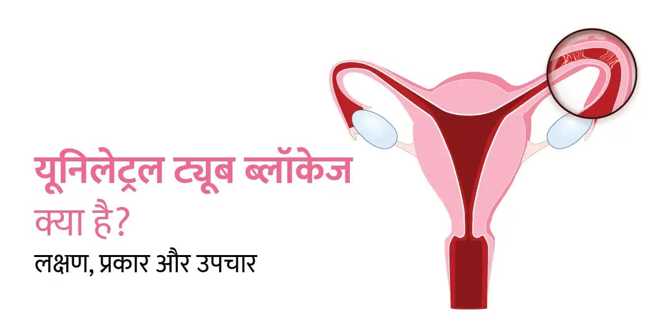Unilateral Tubal Blockage in Hindi – यूनिलेट्रल ट्यूब ब्लॉकेज क्या है? लक्षण, प्रकार और उपचार