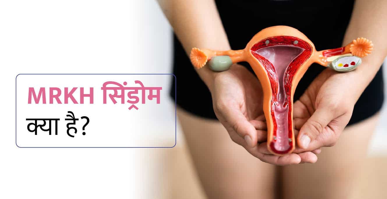MRKH Syndrome in Hindi – एमआरकेएच सिंड्रोम क्या है? कारण, लक्षण और उपचार
