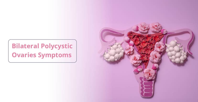ద్వైపాక్షిక PCOS: కారణాలు, లక్షణాలు మరియు చికిత్స
