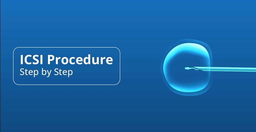 Step-by-Step Guide to the ICSI Procedure