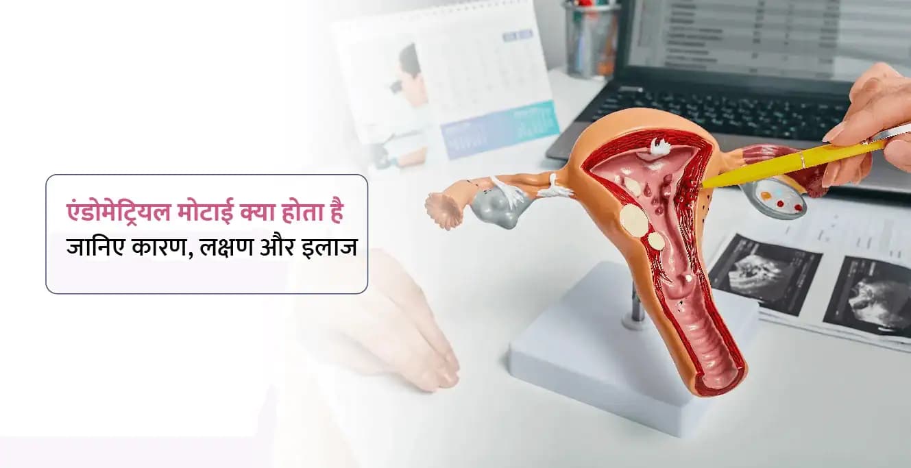 Endometrial Thickness in Hindi: एंडोमेट्रियल मोटाई क्या होता है?