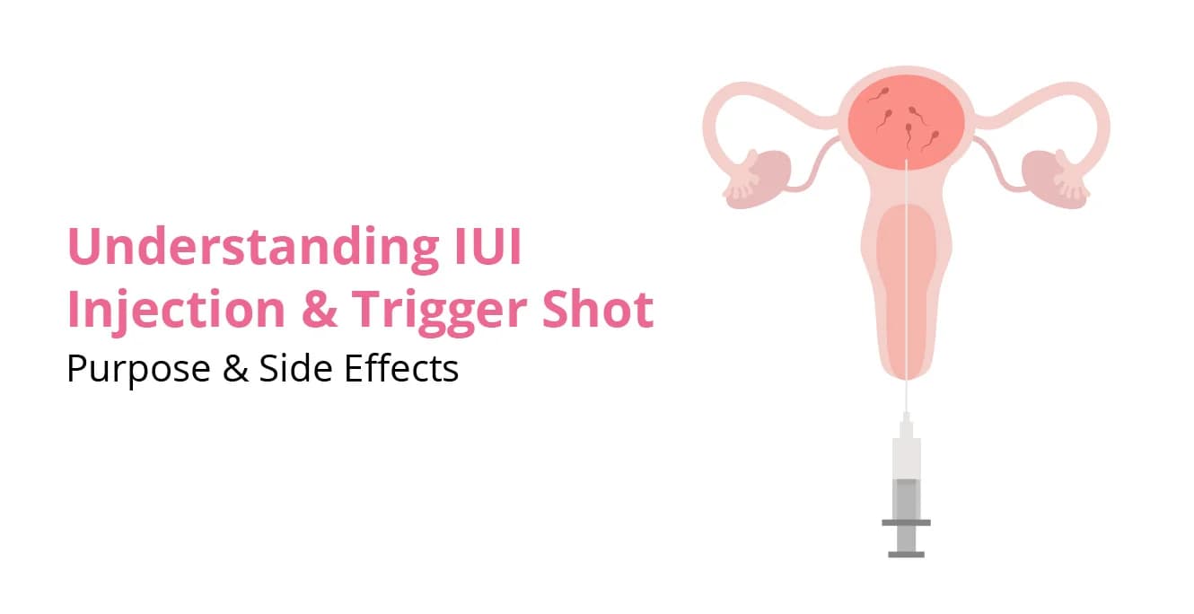 IUI ஊசி மற்றும் தூண்டுதல் ஷாட்டைப் புரிந்துகொள்வது: நோக்கம் மற்றும் பக்க விளைவுகள்