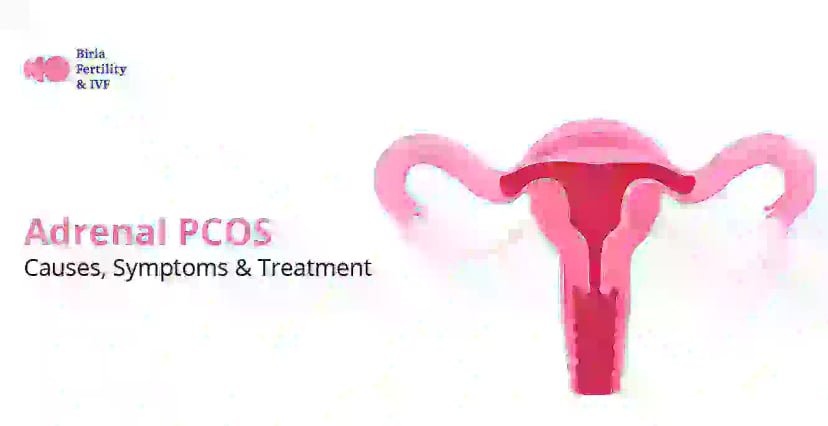 Adrenal PCOS: Causes, Symptoms, and Treatment