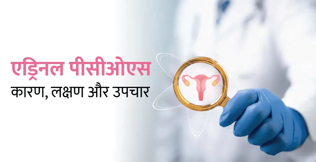 एड्रिनल पीसीओएस: कारण, लक्षण और उपचार
