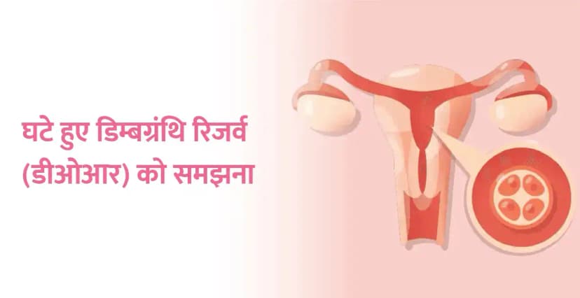 डिमिनिश्ड ओवेरियन रिज़र्व (डीओआर) क्या है? कारण, लक्षण और उपचार