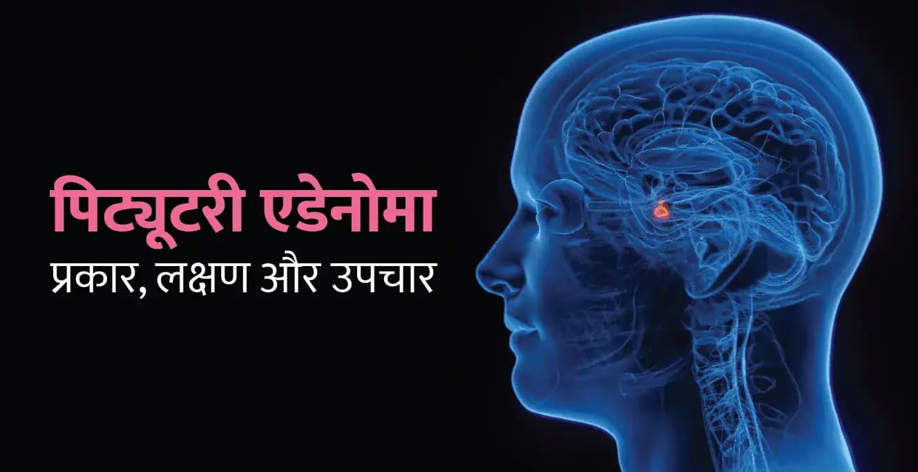 Pituitary Adenoma in Hindi: पिट्यूटरी एडेनोमा के प्रकार, लक्षण और उपचार