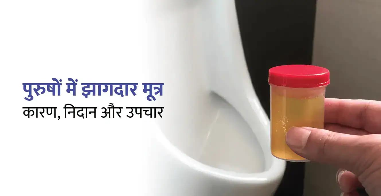 पुरुषों में झागदार मूत्र: कारण, निदान और उपचार