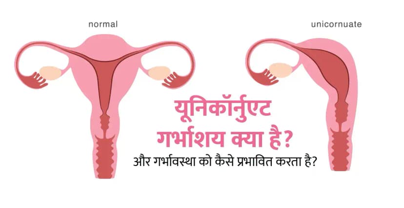 Unicornuate Uterus in Hindi: यूनिकॉर्नुएट गर्भाशय क्या है और गर्भावस्था को कैसे प्रभावित करता है?