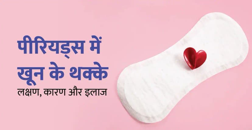 पीरियड्स में खून के थक्के(Menstrual Clots): लक्षण, कारण और इलाज