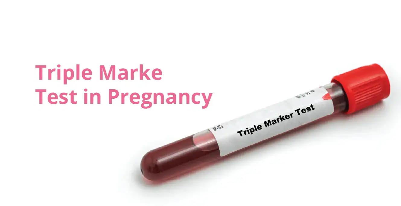 Triple Marker Test in Pregnancy: Purpose, Procedure, Analysis
