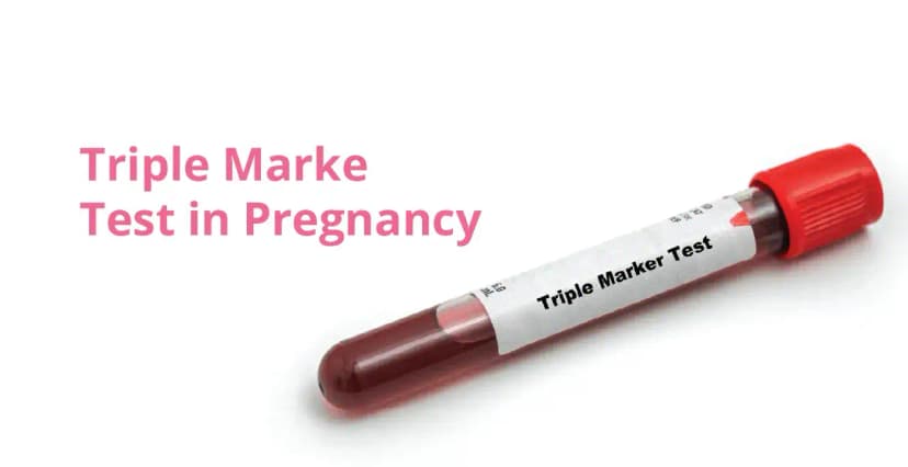 Triple Marker Test in Pregnancy: Purpose, Procedure, Analysis