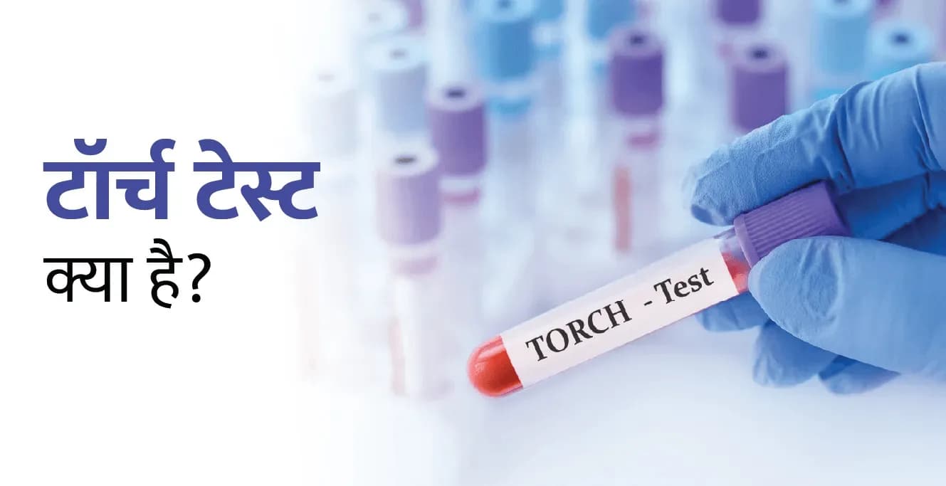TORCH टेस्ट क्या है? गर्भावस्था में इसके महत्व को समझना