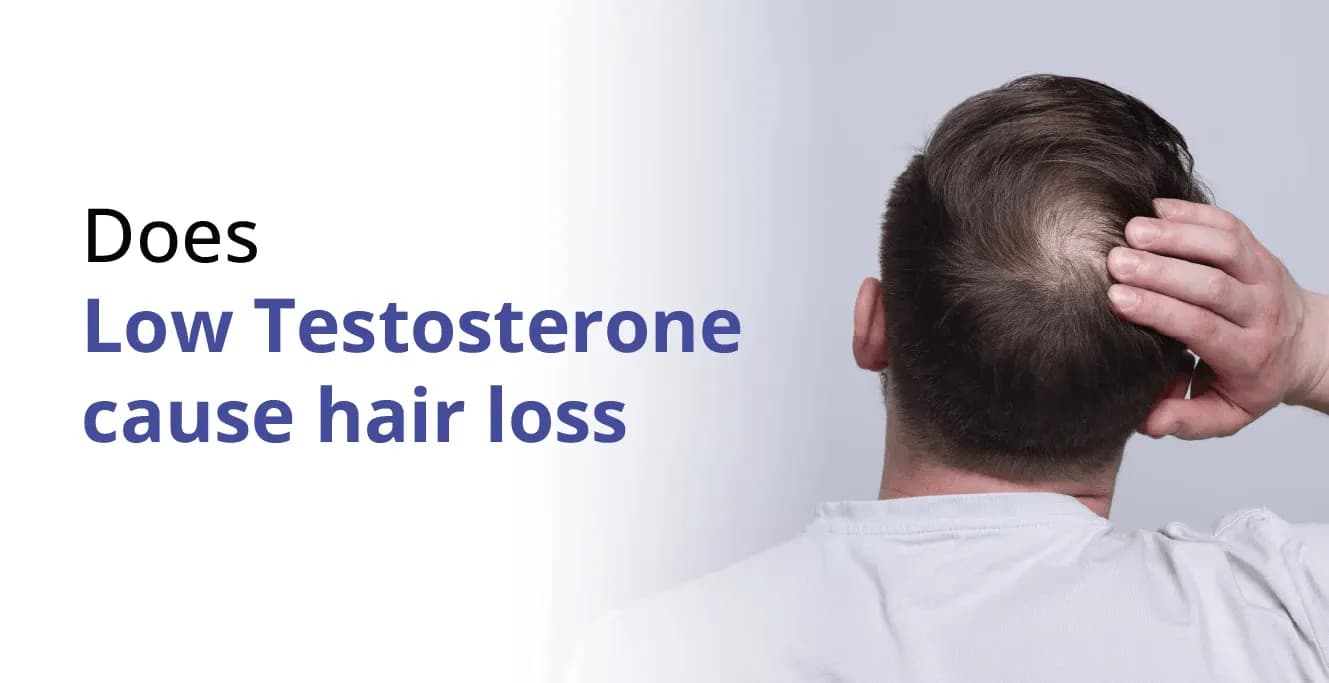 Does Low Testosterone Cause Hair Loss?